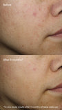 Vitamin C⁺ Serum